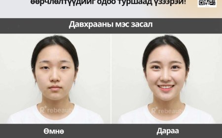 💎 Солонгосын гоо сайхны мэс заслын эмнэлгийн бүх мэдээлэл энд!