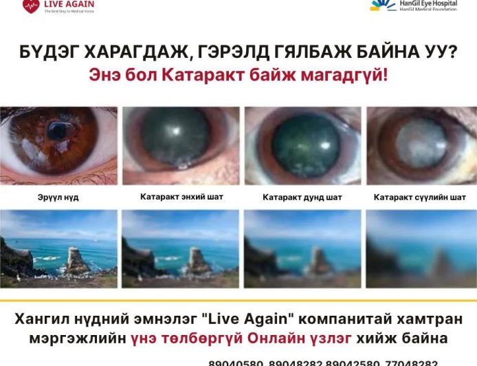 👁️ БҮДЭГ ХАРАГДАЖ, ГЭРЭЛД ГЯЛБАЖ БАЙНА УУ?