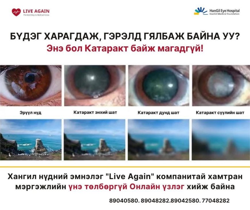 👁️ БҮДЭГ ХАРАГДАЖ, ГЭРЭЛД ГЯЛБАЖ БАЙНА УУ?