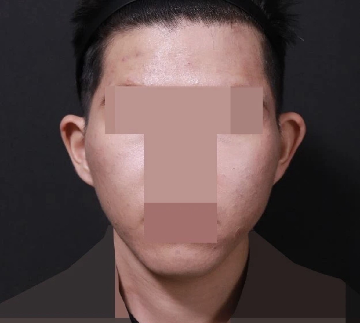 얼굴형이 달라지는게 보여요