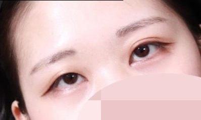 자연스럽고 또렷한 라인이 생겨서 너무 만족합니다!