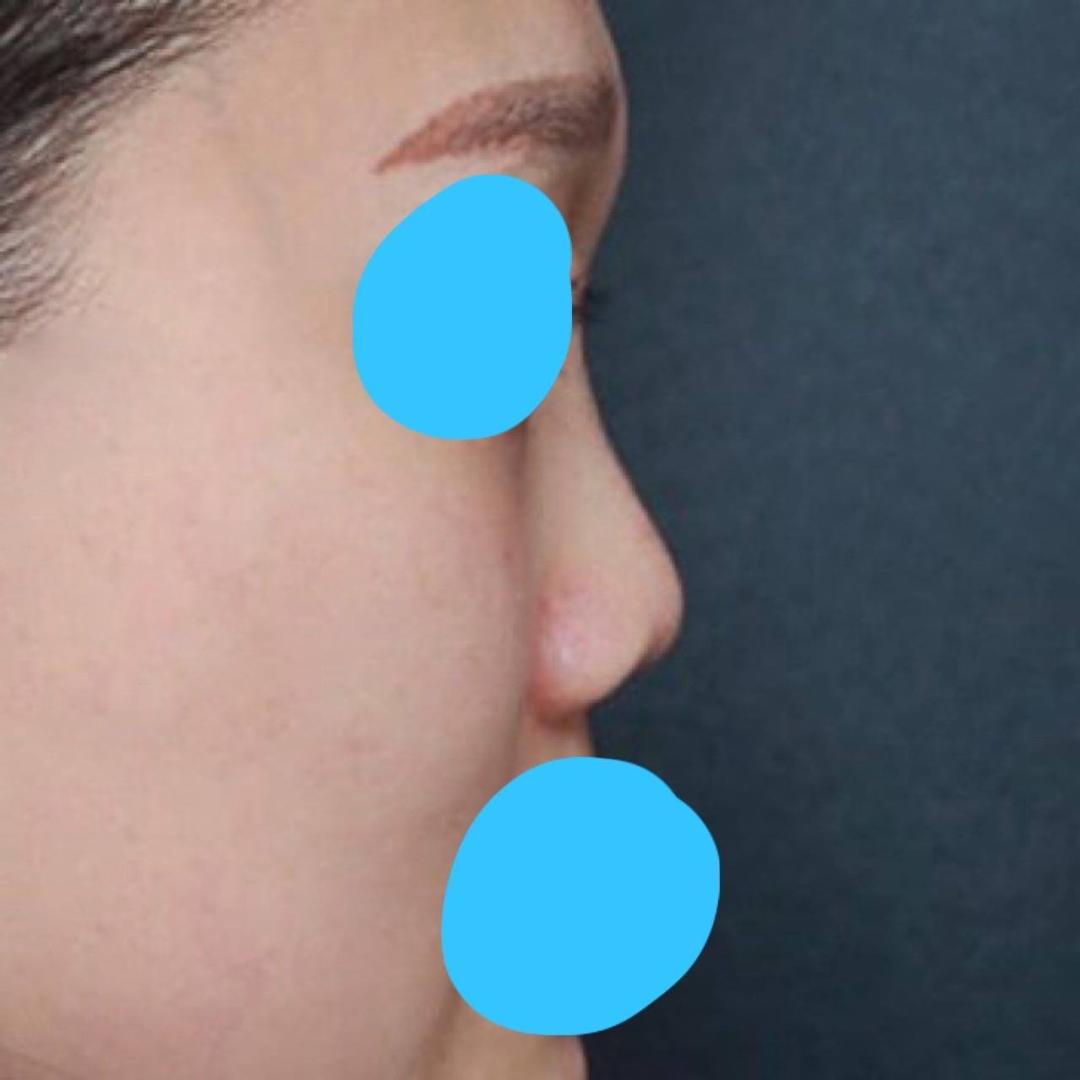 베리굿 임영민원장님 짱