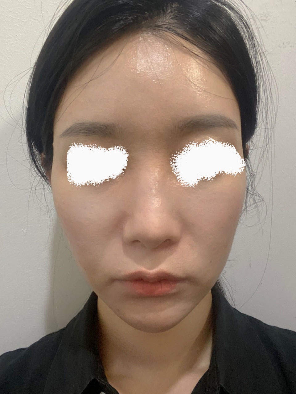 원장님께 긴곡선사각턱 작년에 받고 만족스러워서