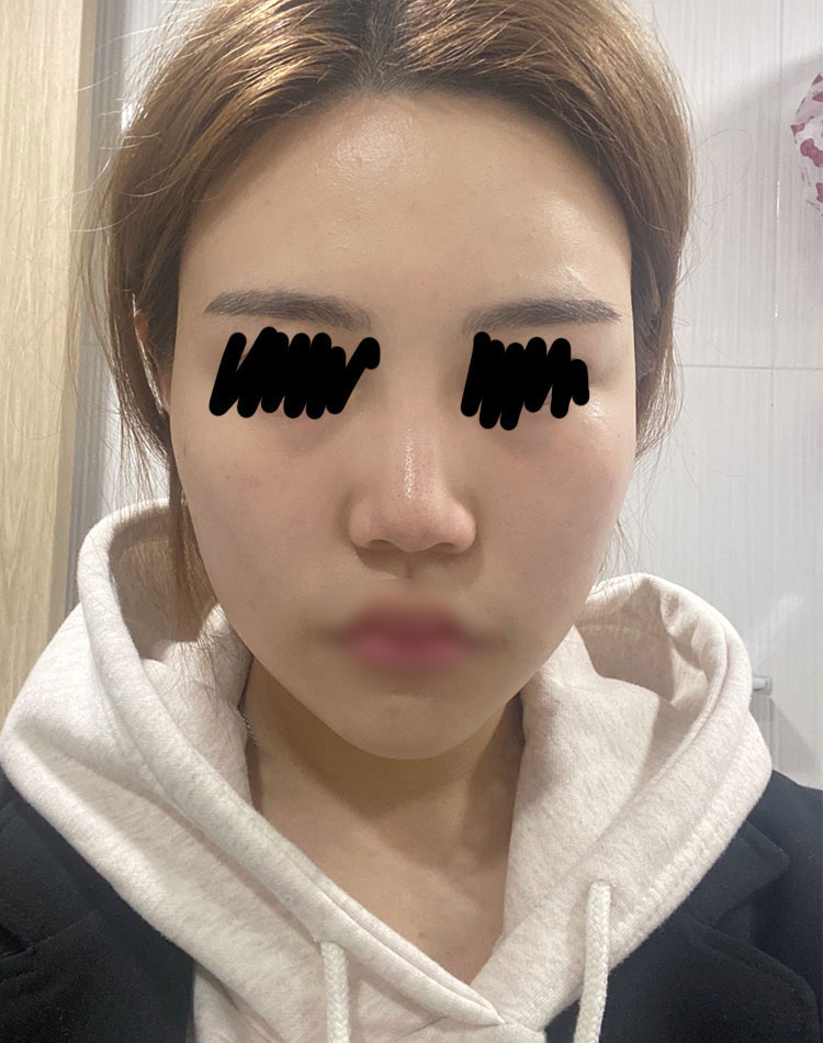 너무 만족하면서 잘 살고 있습니당 !! 다들 고민보단 go.!