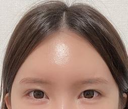 이마거상술 4개월 후기입니다~~