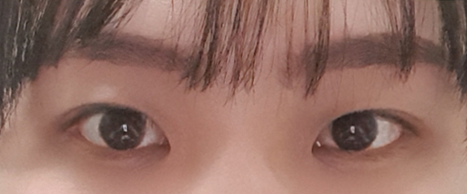 한달만에 이렇게 자연스러워져서 너무 만족해요!ㅎㅎ