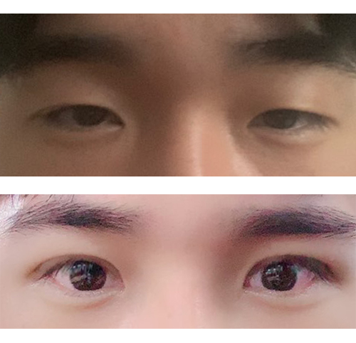 후회없는 선택이에요 ㅎㅎ