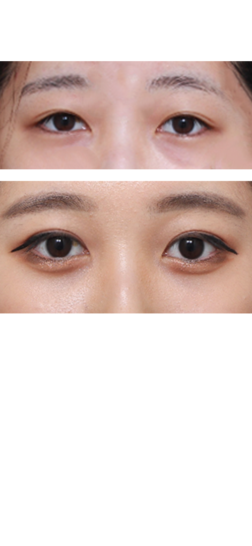 결과는 만족중입니다.