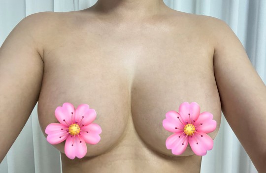 멜론 김주원 원장님 모티바 드뎌 한달차! 후기