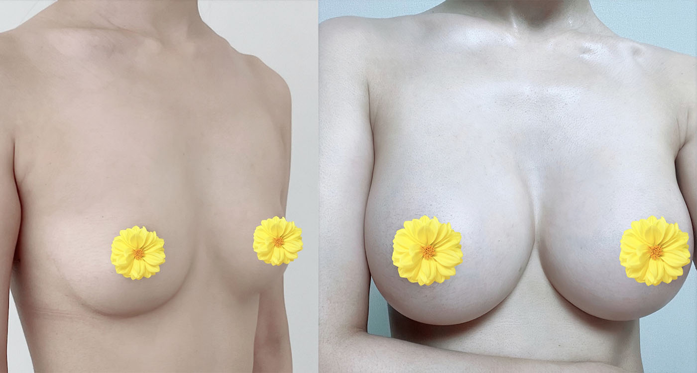 모티바 6개월차) 역시 멜론 선택한건 후회 없어요❤️