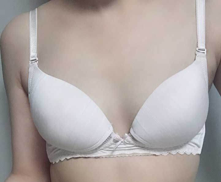 Төрсний дараа хөхний мэс засал хийлгэсэн!