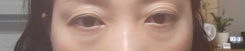 Доод зовхины мэс засал