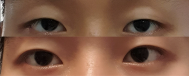 #Мэс ажилбаргүйНүднийКонтурЗасвар