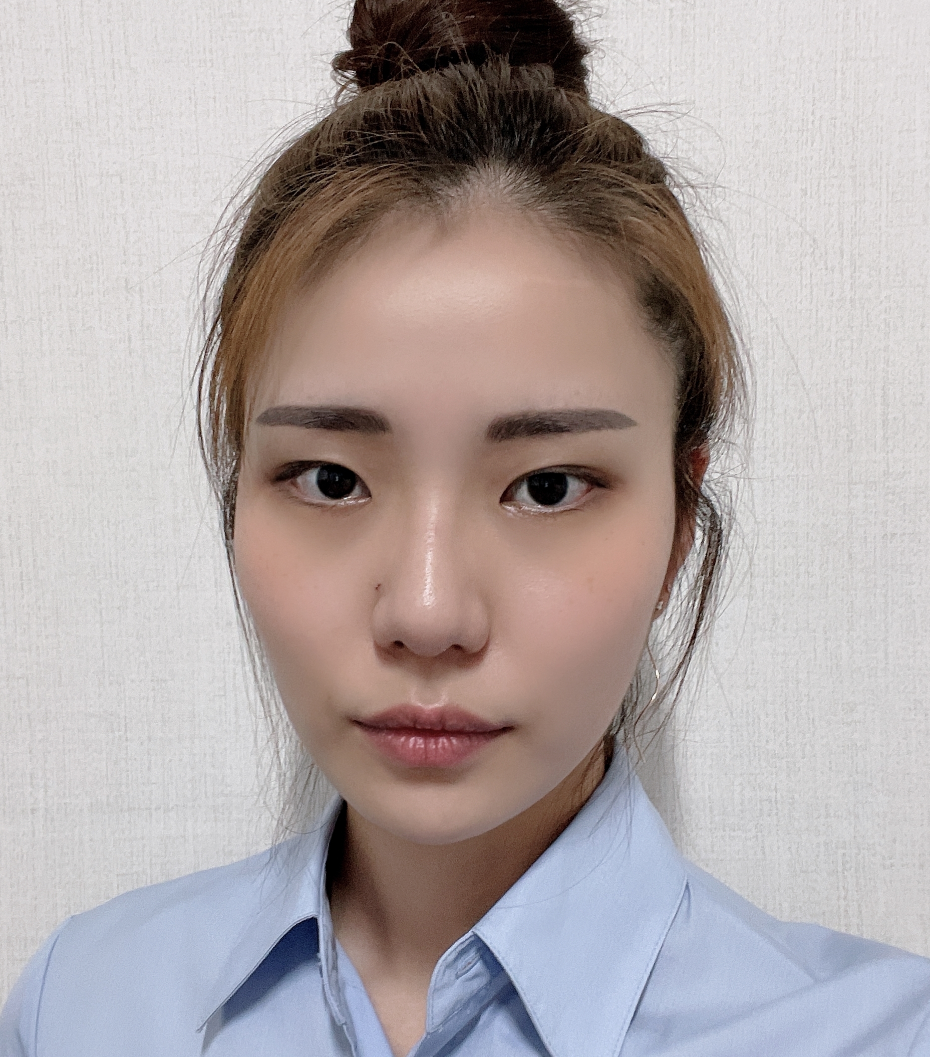 [Нүд] Пэпэрон - Зүсэлгүй Нүдний Хэлбэр Засвар