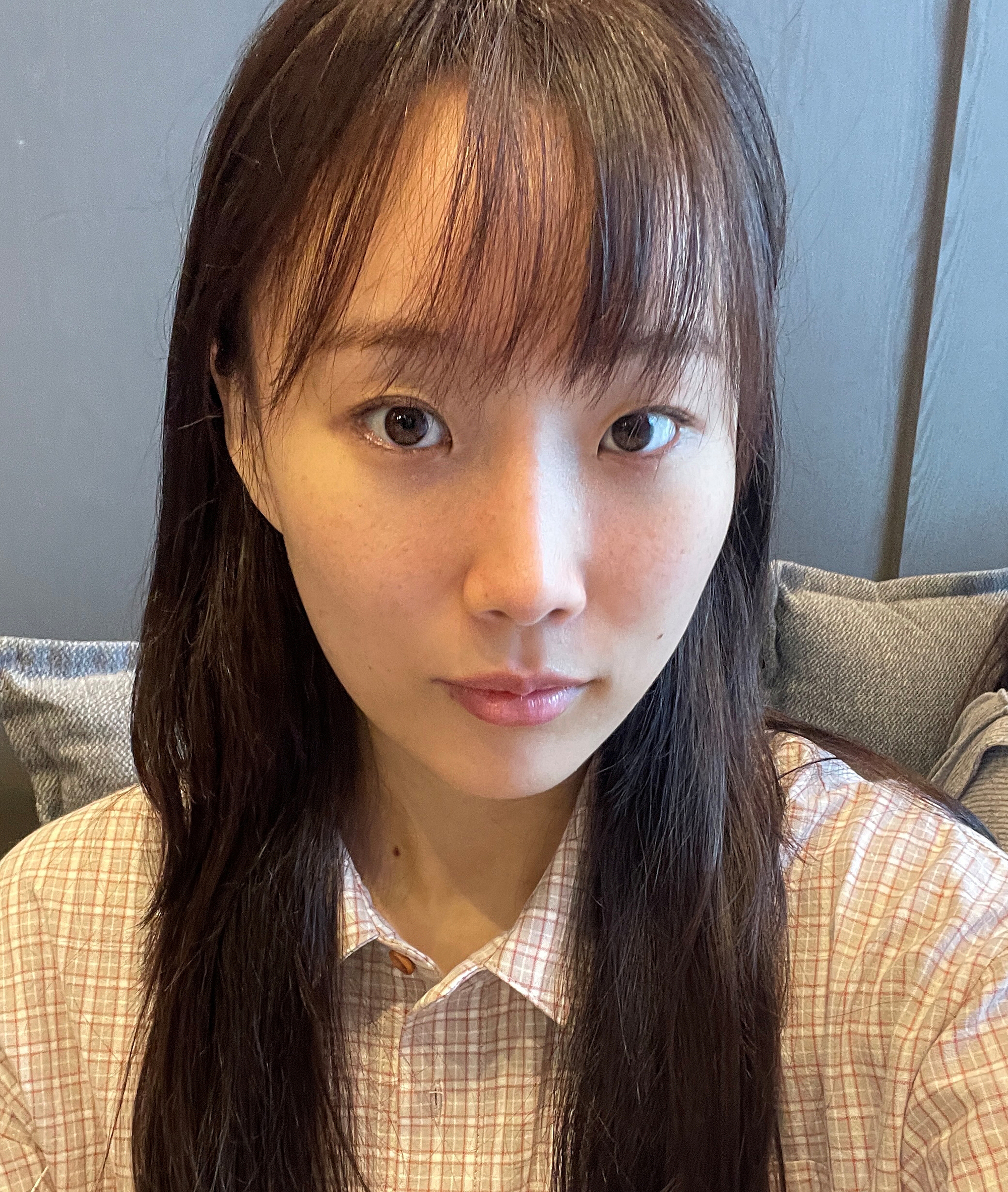 [Нүд] Винини - Зүсэлгүй Нүдний Хэлбэр Засвар, Урд Зовхины Зүслэг