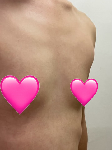 [Цээж] Дөрвөлжин цацраг - Цээж