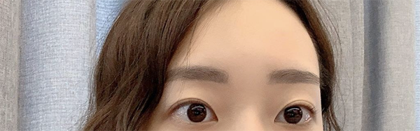 [Нүд] ski03078 - Нүд