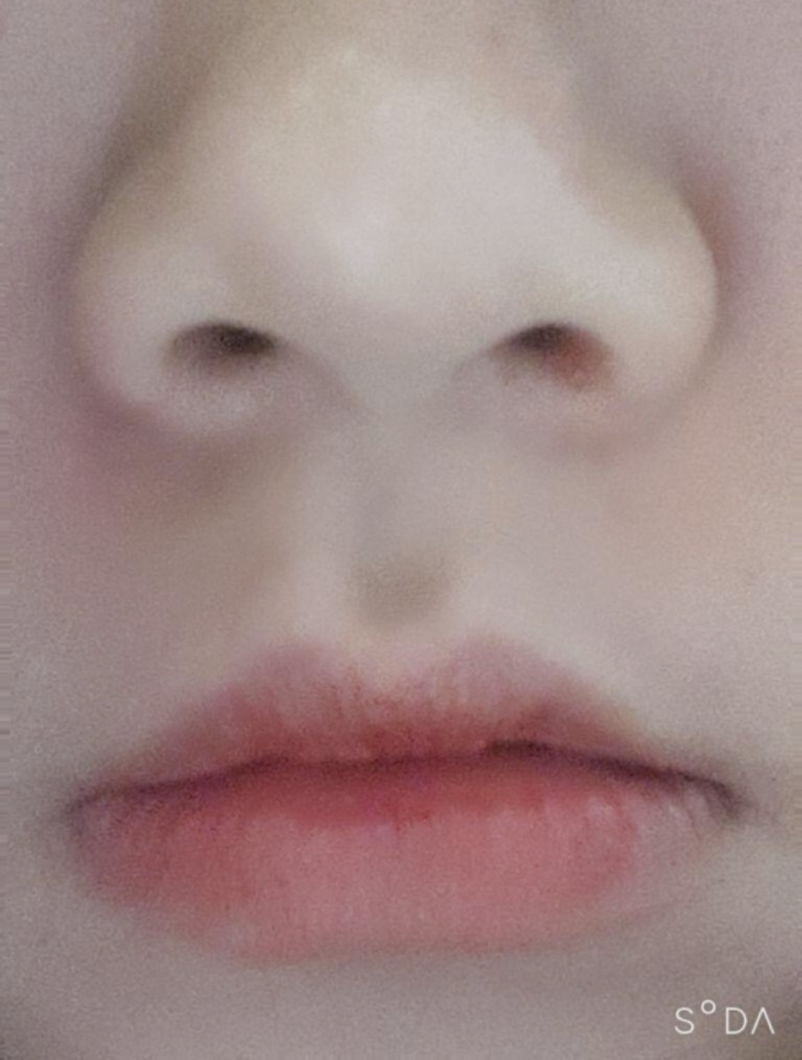 [Бага зэрэг] ds0405 - Ботокс