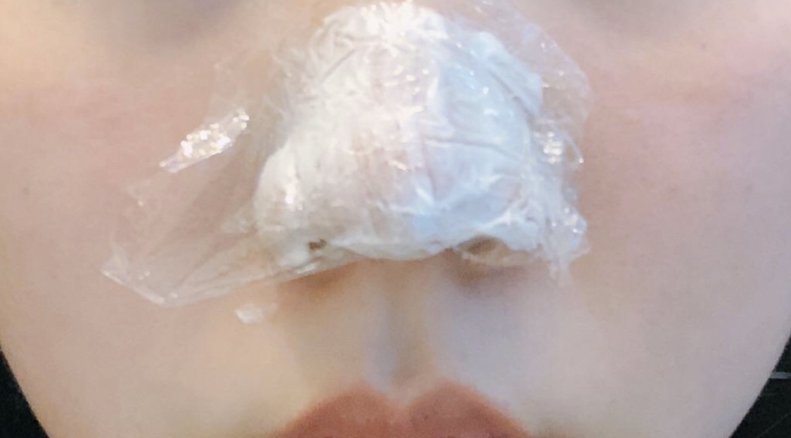 [Бяцхан] Фрюри - Ботокс, хамрын үзүүр