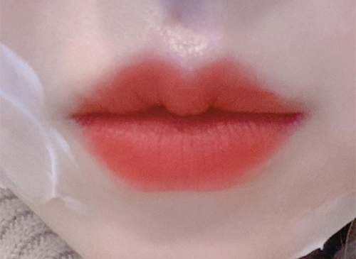 [Бяцхан] hunnie8894 - Уруулын филлер