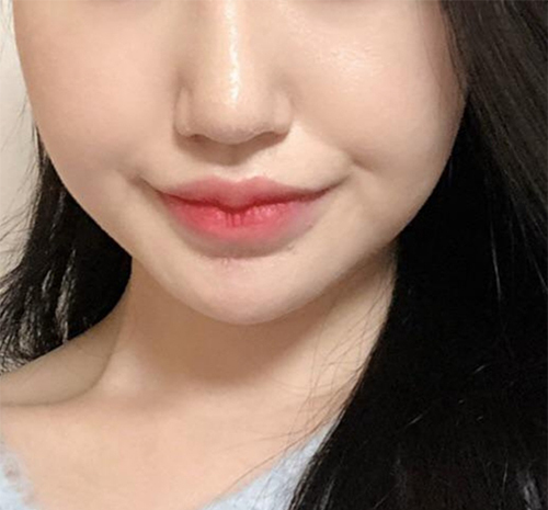 [Арьс] Жижижижижижи - Шринк, Контур Токсин