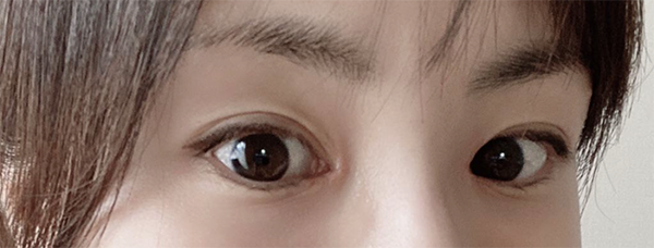 [Нүд] ㅈㅎㅊ - Нүд