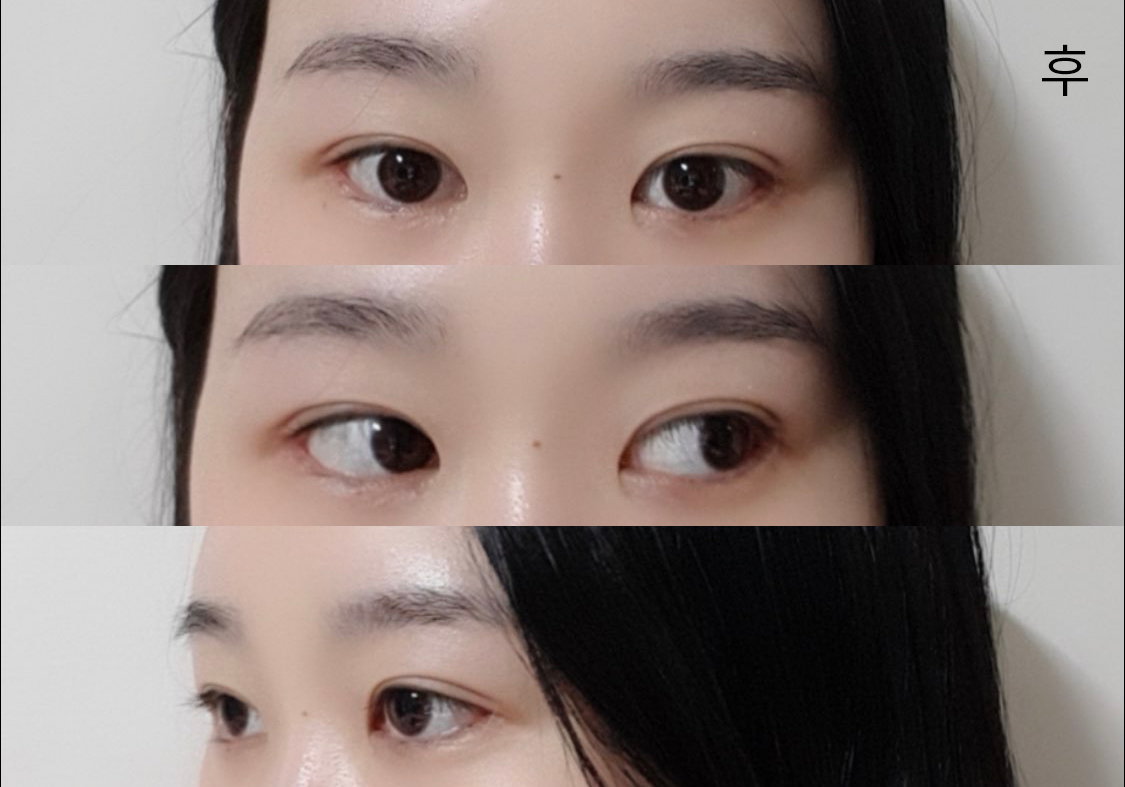 [Нүд] Гисоб - Нүд