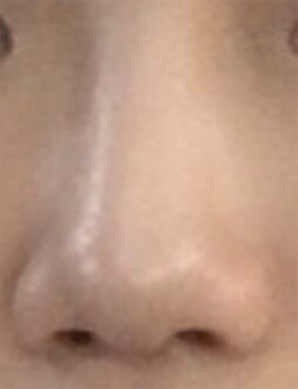 [Жижиг] dbwladl - Хамар