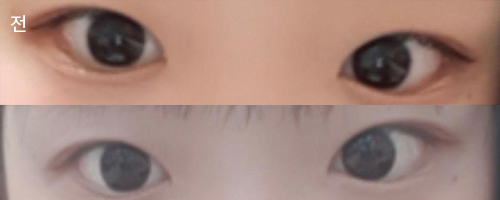 [Нүд] Шин Ынсо - Нүд