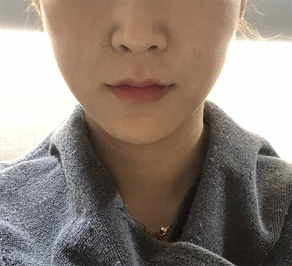 [Арьс] kkkkyu - Ulthera