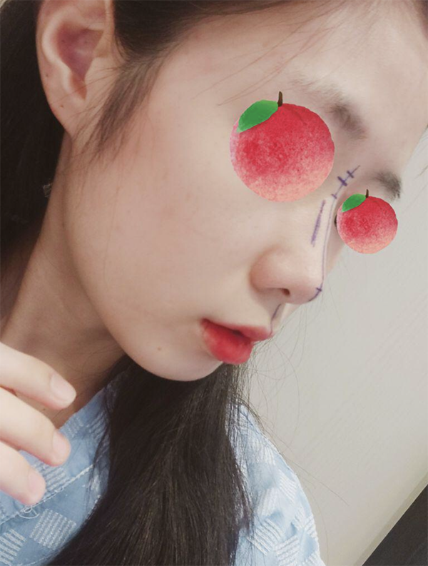 [Хамрын] Дуду Смуди - Хамар