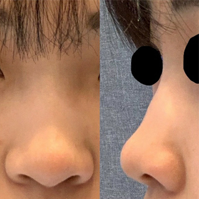 [Хамрын] 뀽뀽공 - Хамар