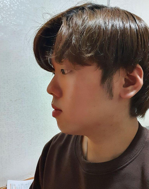 [Эрэгтэй] Хавдаж бүдүүрсэн - Нүд, Хамар