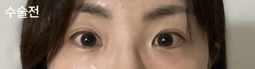 [Нүд] ㅈㅎㅊ - Нүд