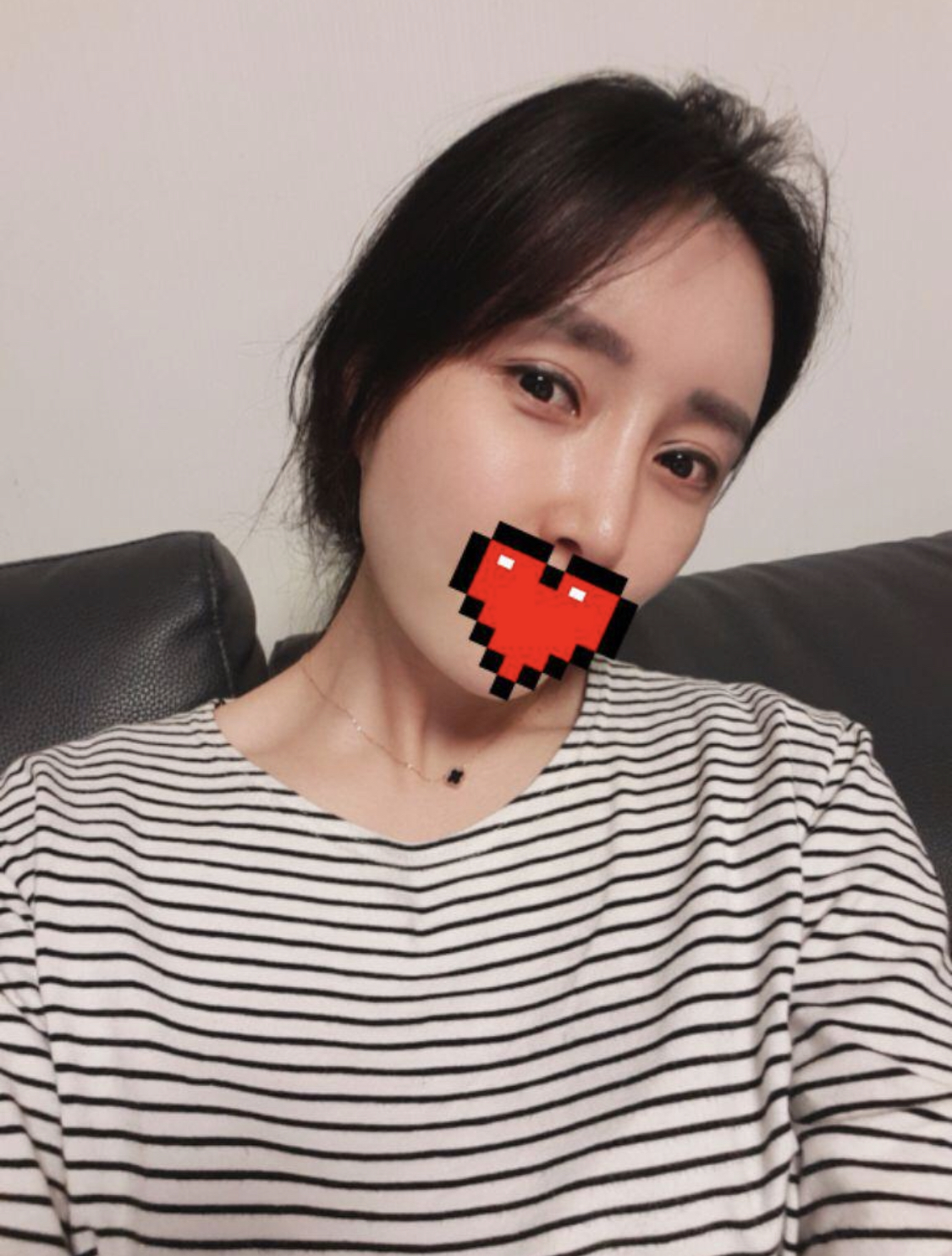 [Хөгшрөлтийн эсрэг] ㅅㄴㄷㄴㅅㅊ - Нүд, Өөх шилжүүлэн суулгах