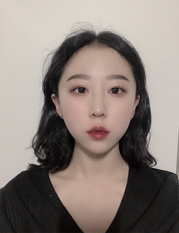 [Бяцхан] Шөнийн Манго Снайпер - Ботокс, Филлер