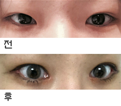 [Нүд] jdnendndj - Нүд