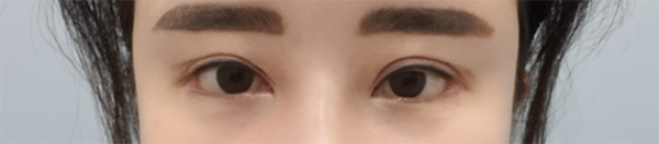 [Нүд] Ккимем - Нүд