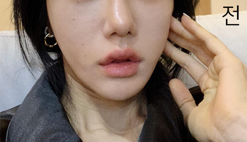 [Арьс] Линггридондон - Эйржет Лифтинг