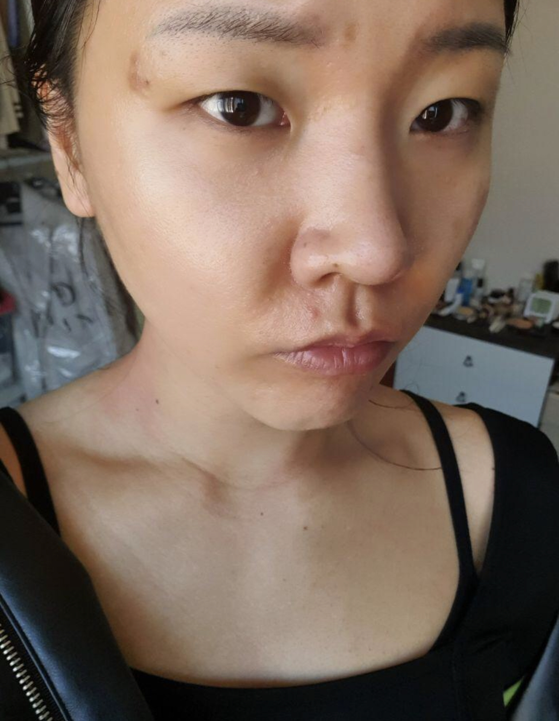 [Нүд] БиннаБитна - Зүсэлт, Засал