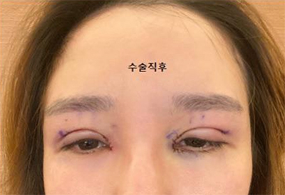 [Нүд] Нарийхан сайхан - Нүд