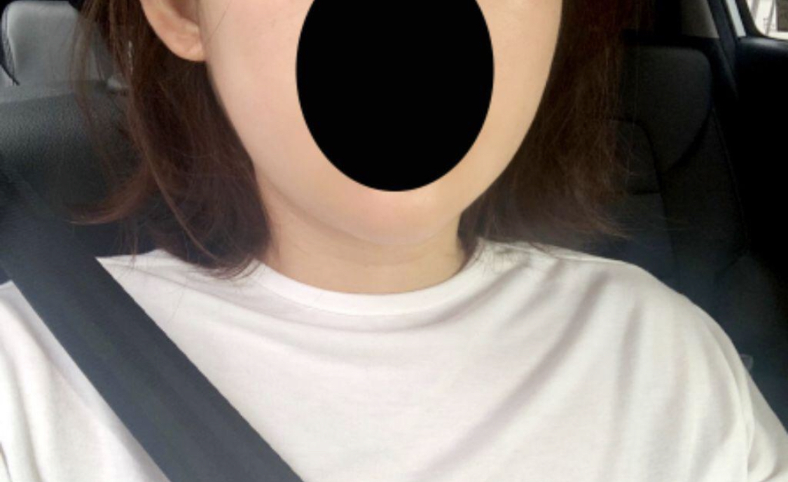 [Анти-Эйджинг] Плэйн817 - Нүүрний өөх соруулах