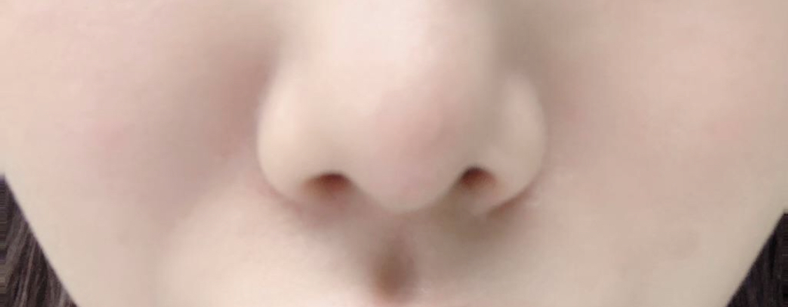 [Анти-Эйджинг] Вониvv - Өөх шилжүүлэн суулгах