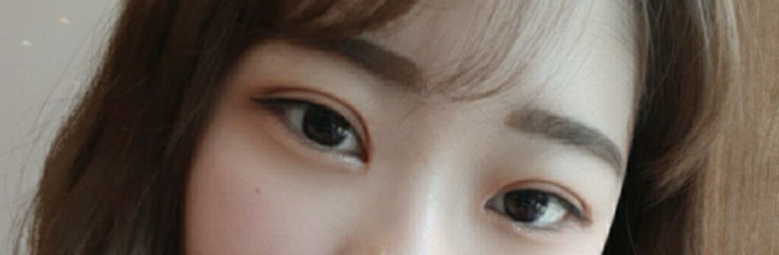 [Нүд] msdmsquf2 - Далд оёдол, Дээд зовхины өргөлт