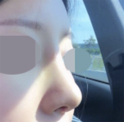 [Хамрын] ggggghhhhhhhh - Хамар