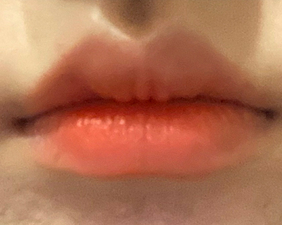 [Бяцхан] Рапунцел@ - Уруулын филлер