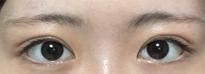 [Нүд] Kwon Dong-ha - Нүд