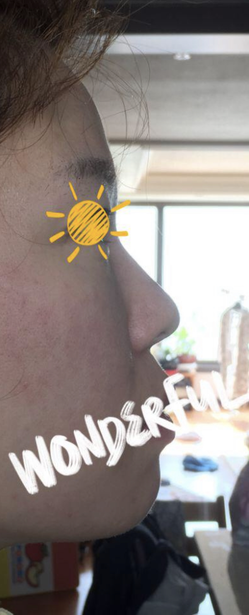 [Хамрын] Shee288 - Хамрын нуруу, хамрын үзүүр