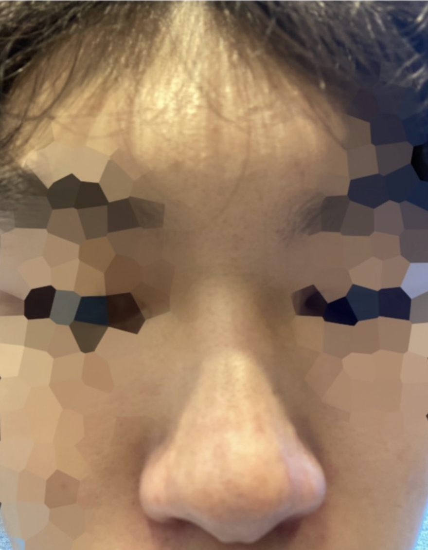 [Хамрын] dlspsl - Хамар