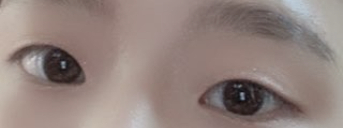 [Нүд] Иsoo - Булсан оёдол, урд зүсэлт